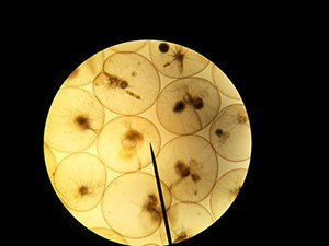 Micro photograph of a sample of bloom courtesy of Lynette Wood, Orcas Island Phytoplankton Survey Team.